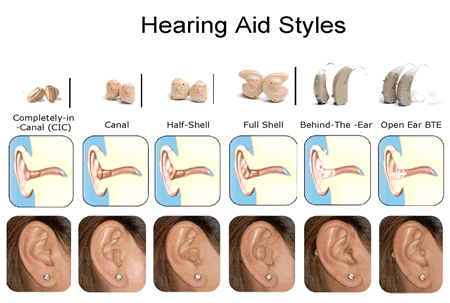 History of Hearing Aids.