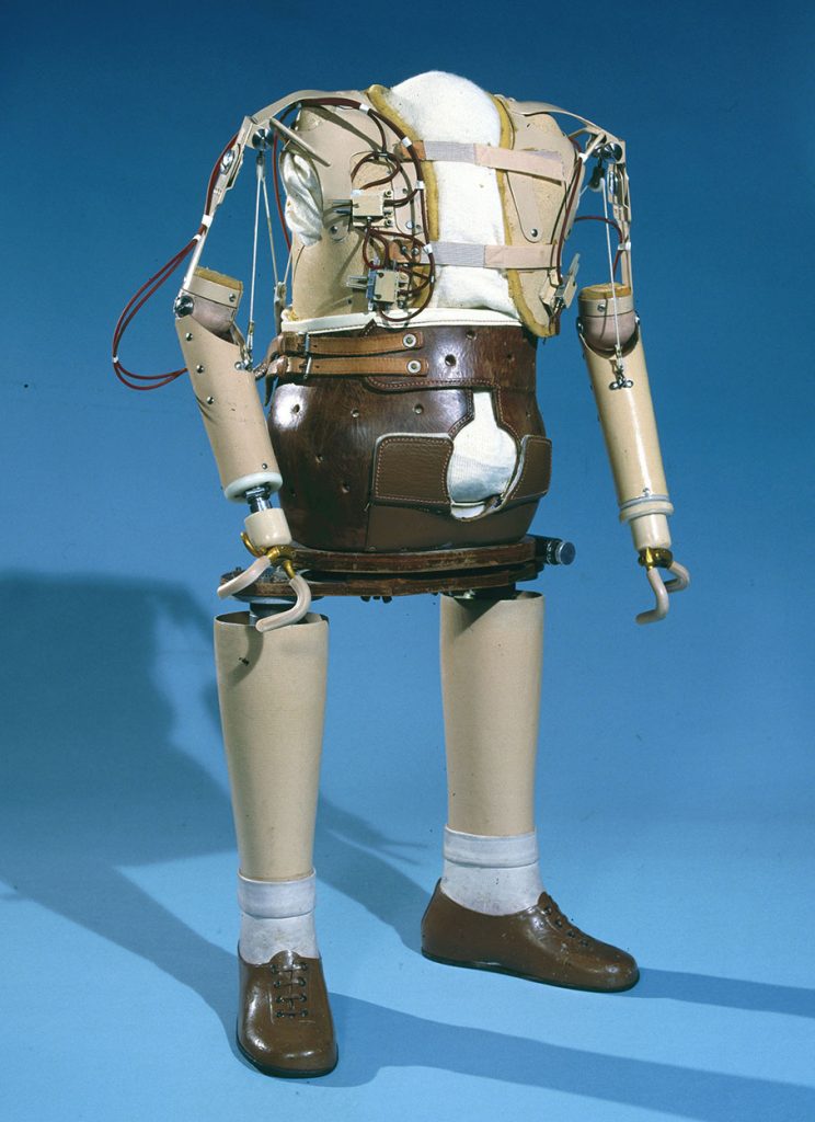 Artificial limbs for a thalidomide child, 1961-1965. (9660575567).jpg
https://commons.wikimedia.org/wiki/File:Artificial_limbs_for_a_thalidomide_child,1961-1965.(9660575567).jpg / Science Museum London / Science and Society Picture Library / CC BY-SA (https://creativecommons.org/licenses/by-sa/2.0) No alterations made.